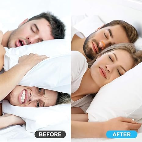 SMOOTHFLOW™ Nasal Strips